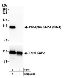 KAP1, p Ser824 Antibody (BL-246-7B5), Novus Biologicals 100 &mu;L | Buy Online | Novus Biologicals | Fisher Scientific